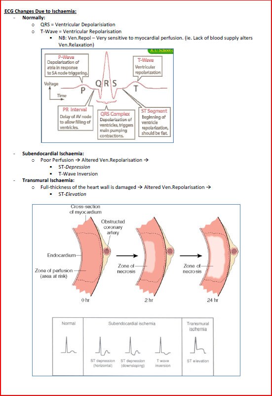 Comprehensive Cardiovascular System Study Notes PDF - Ideal for NCLEX, USMLE Exam Prep - 256 Pages - Best for Medical and Nursing Students