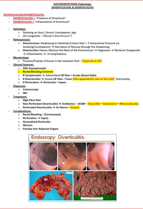 Comprehensive Gastrointestinal System Notes - Ideal for NCLEX, USMLE Exam Prep - 313 Pages - Best for Medical and Nursing Students